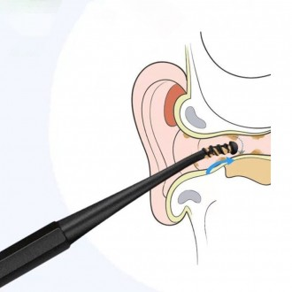 Ráy tai, vệ sinh tai, ngoáy tai, vạt sau tai, lấy ráy tai, cắt dái tai A/B