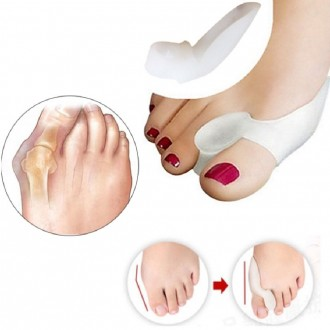 Ống lót ngón chân cái Hallux valgus bằng silicone 2P